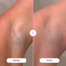 Lade das Bild in den Galerie-Viewer, EpiLuxe